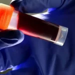 این گروه خونی بیشترین احتمال سکته مغزی را دارد!